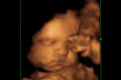 Dallas Newborn