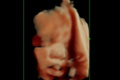 Dallas Newborn