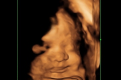 Dallas Newborn