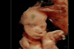 Dallas Newborn