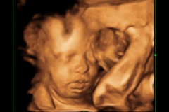 Dallas Newborn