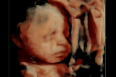 Dallas Newborn