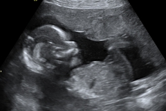 Dallas Newborn