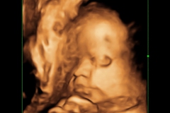 Dallas Newborn