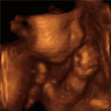 3d ultrasound mansfield tx